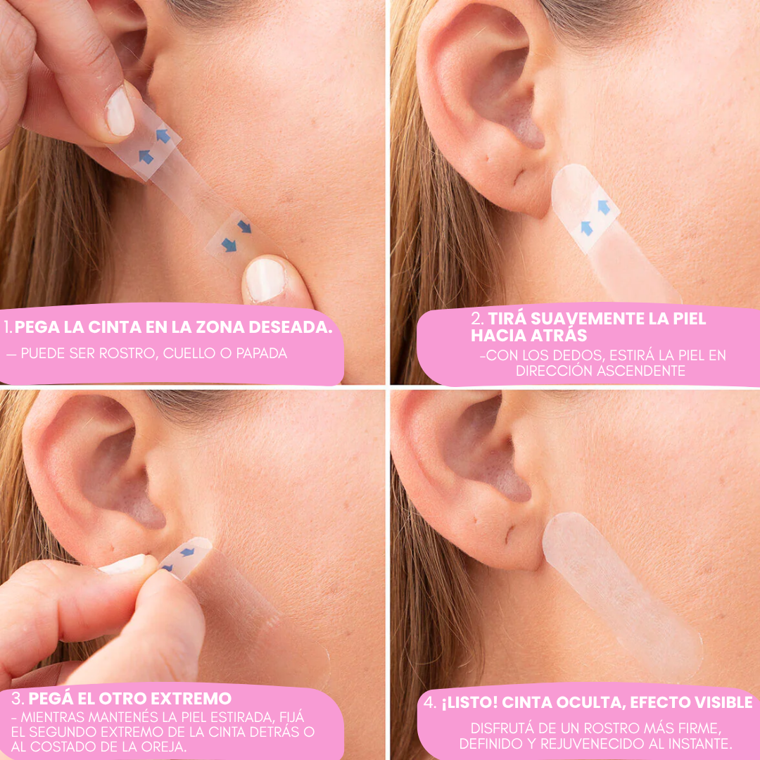 Lyra® Face Lifting | Redefiní tu rostro en 10 segundos