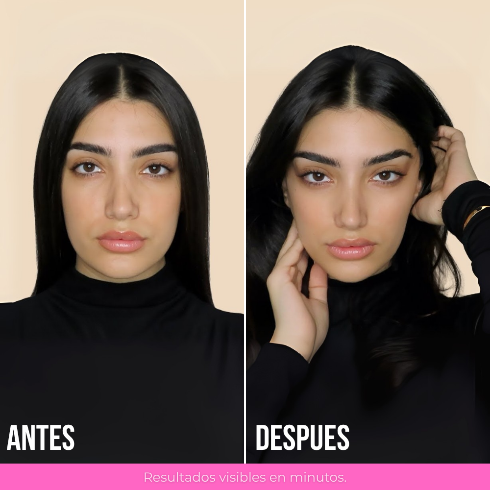 Lyra® Face Lifting | Redefiní tu rostro en 10 segundos