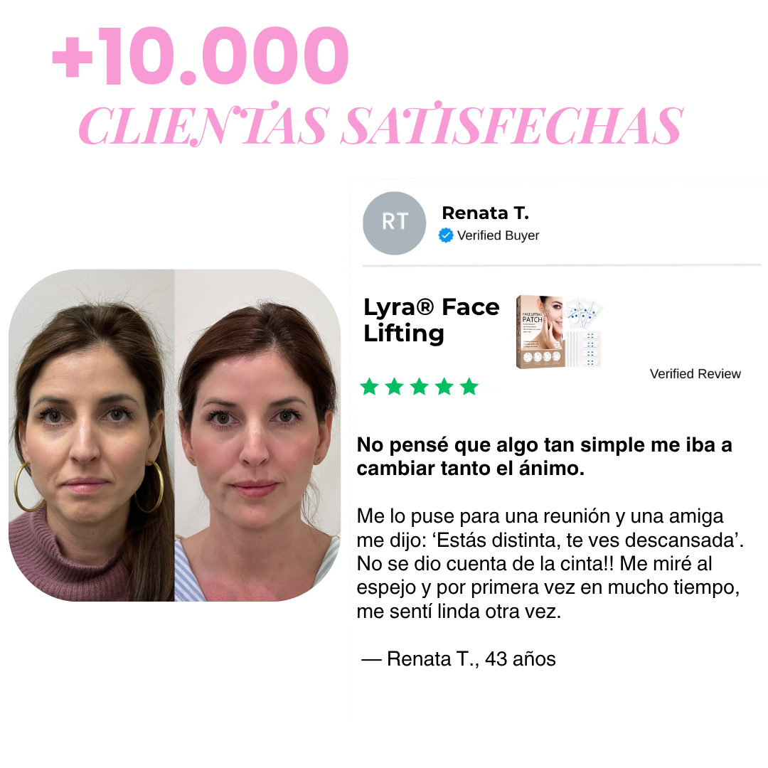 Lyra® Face Lifting | Redefiní tu rostro en 10 segundos