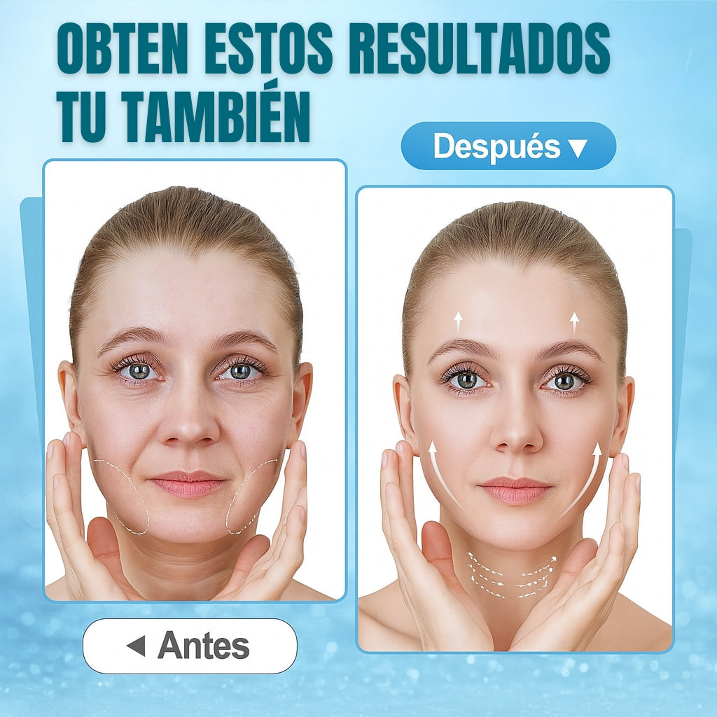 Skintense - Parche estiramiento facial
