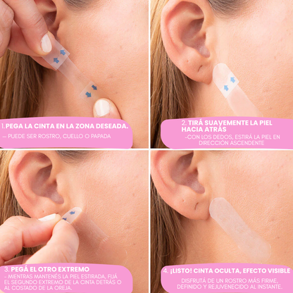 Lyra® Face Lifting | Redefiní tu rostro en 10 segundos