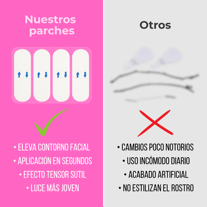 Lyra® Face Lifting | Redefiní tu rostro en 10 segundos
