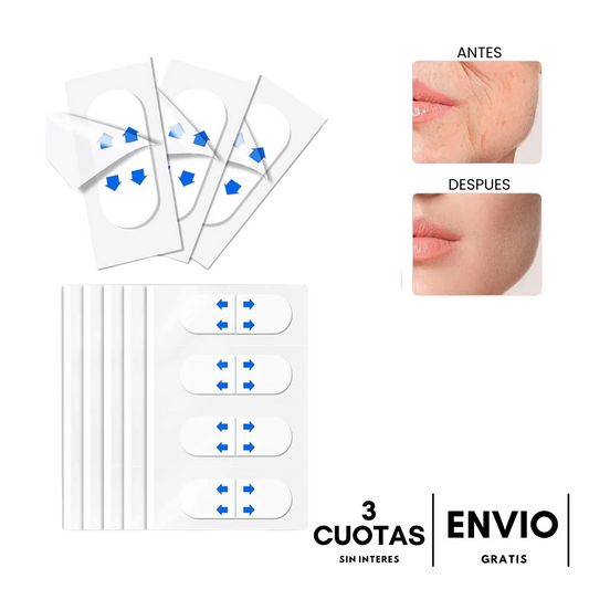 Lyra® Face Lifting | Redefiní tu rostro en 10 segundos